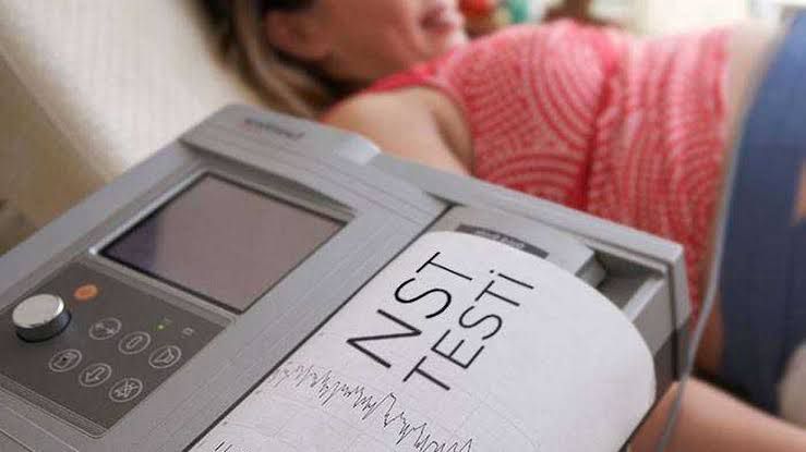 NST Non Stres Testi